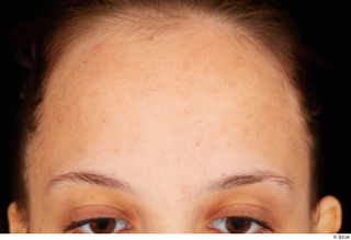 Jennifer Mendez forehead head 0001.jpg